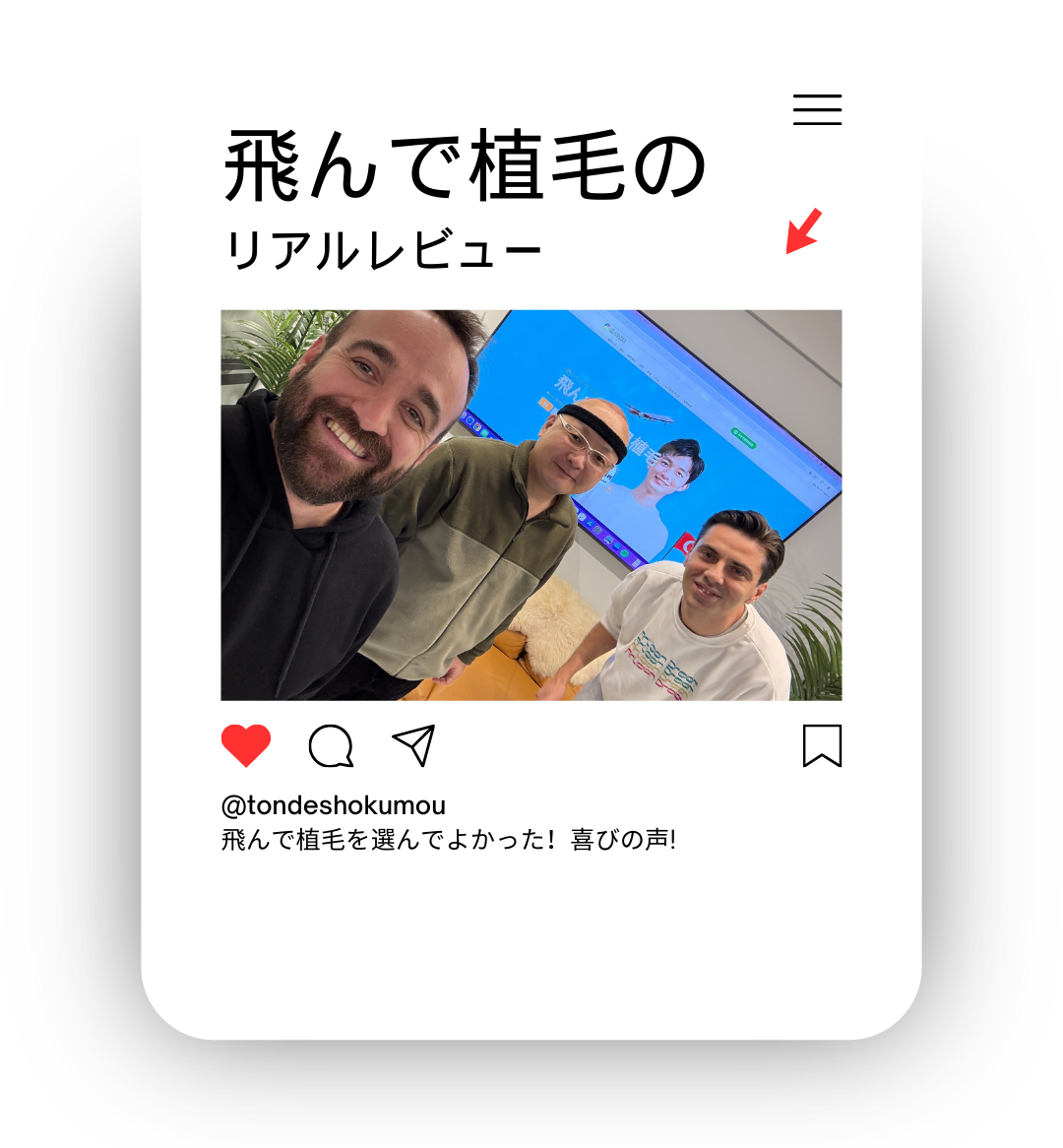 トルコ植毛の体験談